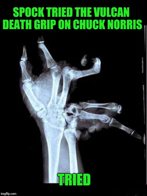 Ouch! | SPOCK TRIED THE VULCAN DEATH GRIP ON CHUCK NORRIS; TRIED | image tagged in broken hand,star trek week | made w/ Imgflip meme maker