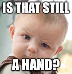 Skeptical Baby Meme | IS THAT STILL A HAND? | image tagged in memes,skeptical baby | made w/ Imgflip meme maker