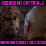 I don't know about you but it looks like one to me... | ESCUSE ME CAPTAIN...? MY FOREHEAD LOOKS LIKE A WHAT?!? | image tagged in lt worf,star trek tng,memes,funny,klingon,worf | made w/ Imgflip meme maker