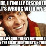 dr who crazy | DUDE, I FINALLY DISCOVERED WHAT'S WRONG WITH MY BRAIN; ON THE LEFT SIDE THERE'S NOTHING RIGHT AND ON THE RIGHT SIDE THERE'S NOTHING LEFT | image tagged in dr who crazy | made w/ Imgflip meme maker