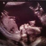 Fetus Cat Ultrasound