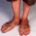 HobbitFeet meme