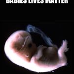 Fetus | BABIES LIVES MATTER | image tagged in fetus | made w/ Imgflip meme maker