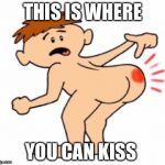 Butthurt | THIS IS WHERE; YOU CAN KISS | image tagged in butthurt | made w/ Imgflip meme maker