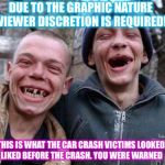 ugly twins | DUE TO THE GRAPHIC NATURE VIEWER DISCRETION IS REQUIRED! THIS IS WHAT THE CAR CRASH VICTIMS LOOKED LIKED BEFORE THE CRASH. YOU WERE WARNED | image tagged in ugly twins | made w/ Imgflip meme maker