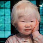 Albino Asian Baby