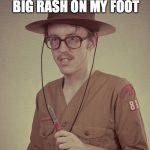 boy scout  | I AM ALLERGIC TO CATS.  I GET A BIG RASH ON MY FOOT; WHEN I KICK THEM | image tagged in boy scout | made w/ Imgflip meme maker