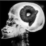shitbrain