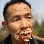 Chinese Teeth