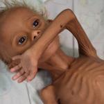 hungry yemen kid