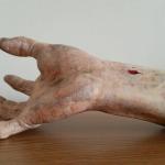 Severed hand