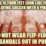 Ugly Feet | FOLKS, IF YOUR FEET LOOK LIKE YOU'VE BEEN PLAYING SOCCER WITH A PINEAPPLE, DO NOT WEAR FLIP-FLOPS OR SANDALS OUT IN PUBLIC | image tagged in ugly feet,flipflop,funny,funny memes | made w/ Imgflip meme maker