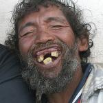 ugly teeth man
