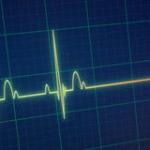 flat line ,electrocardiogram