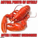 Lobster | ACTUAL PHOTO OF MYSELF; AFTER I FORGET SUNSCREEN | image tagged in lobster | made w/ Imgflip meme maker