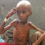 Starving African 