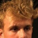 Jake Paul's hairline 