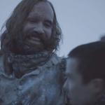 The Hound Whinging