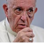 Pope Francis Black Eye
