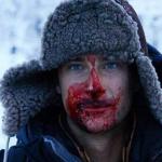 Bear grylls bloody