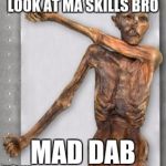 hit the dab | LOOK AT MA SKILLS BRO; MAD DAB | image tagged in hit the dab | made w/ Imgflip meme maker
