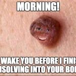 Overly Attached Wart | MORNING! DID I WAKE YOU BEFORE I FINISHED DISOLVING INTO YOUR BODY | image tagged in overly attached wart,meme | made w/ Imgflip meme maker