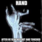 Broken Hand | THE GRIM REAPER’S HAND; AFTER HE REACHED OUT AND TOUCHED; CHUCK NORRIS | image tagged in broken hand,memes,chuck norris | made w/ Imgflip meme maker