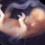 Fetus #MeToo
