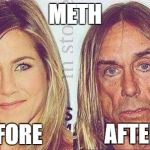 Drugs | METH; BEFORE; AFTER | image tagged in drugs | made w/ Imgflip meme maker