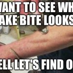 Snake bite | I WANT TO SEE WHAT A SNAKE BITE LOOKS LIKE; WELL LET'S FIND OUT | image tagged in snake bite | made w/ Imgflip meme maker