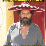 mexican | WHO CARES IF YOU HAVE STRETCH MARKS OR ACNE; TORTILLAS HAVE SPOTS TOO AND THEY ARE STILL GOOD AF | image tagged in mexican,acne,self-worth | made w/ Imgflip meme maker