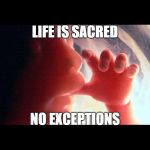 Abortion | LIFE IS SACRED; NO EXCEPTIONS | image tagged in abortion | made w/ Imgflip meme maker