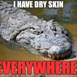 Crocodile | I HAVE DRY SKIN; EVERYWHERE! | image tagged in crocodile | made w/ Imgflip meme maker