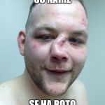 Broken Nose | SU NARIZ; SE HA ROTO | image tagged in broken nose | made w/ Imgflip meme maker