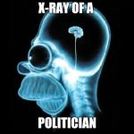 X-RAY OF A; POLITICIAN | image tagged in xray | made w/ Imgflip meme maker