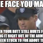 Ouch! That's gonna leave a mark. | THE FACE YOU MAKE; WHEN YOUR BUTT STILL HURTS FROM RIPPING IT RIGHT OUT OF THE ARM CHAIR YOU'VE BEEN STUCK TO FOR ABOUT TEN YEARS. | image tagged in jon gruden the face you make,memes,nfl football,chair,butthurt,monday | made w/ Imgflip meme maker