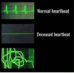normal heartbeat deceased heartbeat meme