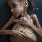 Yemeni Famine