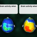 Brain activity