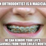 Braces | AN ORTHODONTIST IS A MAGICIAN. HE CAN REMOVE YOUR LIFE'S SAVINGS FROM YOUR CHILD'S MOUTH | image tagged in braces | made w/ Imgflip meme maker