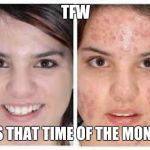 All ladies know what I'm talking about. | TFW; ITS THAT TIME OF THE MONTH | image tagged in before and after acne meme,menstruation,that time of the month,women | made w/ Imgflip meme maker