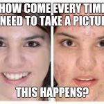 Its so gross. | HOW COME EVERY TIME I NEED TO TAKE A PICTURE; THIS HAPPENS? | image tagged in before and after acne meme,puberty,picture | made w/ Imgflip meme maker