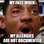 Allergy | MY FACE WHEN; MY ALLERGIES ARE NOT DOCUMENTED | image tagged in allergy | made w/ Imgflip meme maker