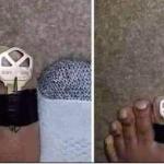 Key toe