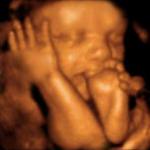 Aborted Son meme