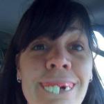 Missing teeth lady