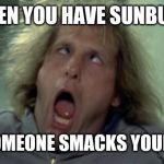 Scary Harry | WHEN YOU HAVE SUNBURN; AND SOMEONE SMACKS YOUR BACK | image tagged in memes,scary harry | made w/ Imgflip meme maker