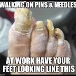 Jroc113 | WALKING ON PINS & NEEDLES; AT WORK HAVE YOUR FEET LOOKING LIKE THIS | image tagged in ugly toe nails | made w/ Imgflip meme maker