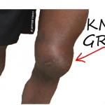 Knee Grow Please!