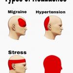 Types Of Headaches meme